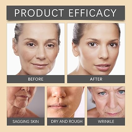 كريم سم النحل للتجاعيد من اوهو